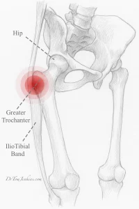 Iliotibial band
