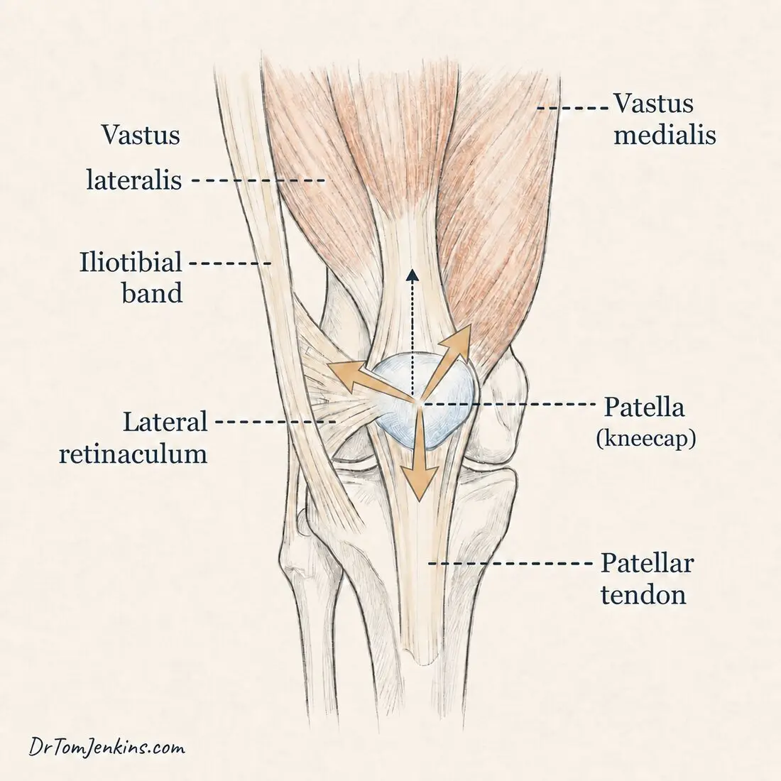 The extensor mechanism: vastus medialis, vastus lateralis, iliotibial band and lateral retinaculum balancing the patella in its groove