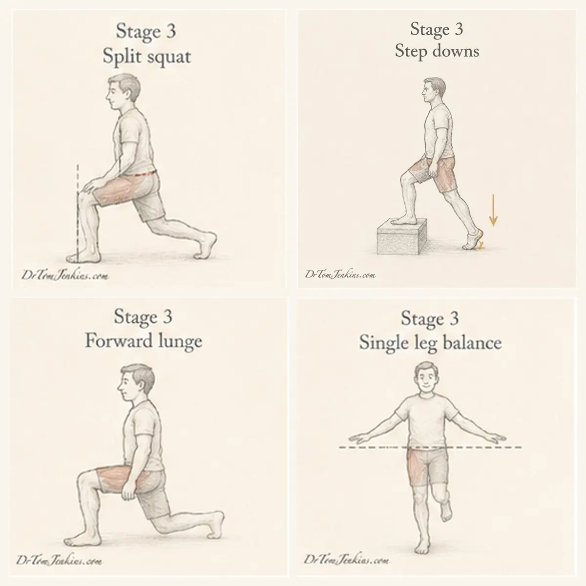 Stage 3 knee exercises: split squat, step downs, forward lunge and single leg balance